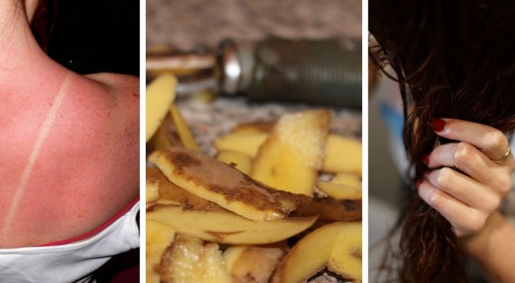 5 buone ragioni per non gettare le bucce di patata e riutilizzarle in modo alternativo