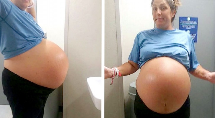 A mother gives birth to a 13 pound baby: her stomach was "as big as a beach ball" 
