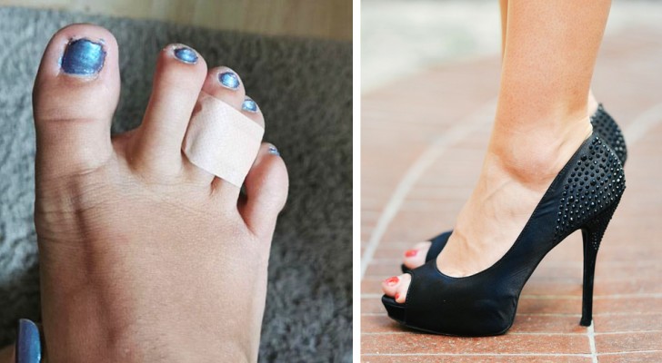 6 nützliche Tricks, wie man hohe Schuhe trägt, ohne zu Leiden, und seine Füße schont
