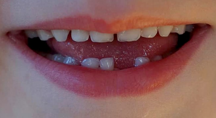 9 psychologische Hinweise, um zu verstehen, warum wir oft von ausfallenden Zähnen träumen