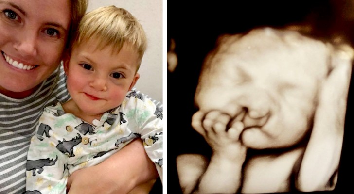 El feto tiene algo que no anda bien, pero se niegan a abortar: 2 años después están más felices que nunca