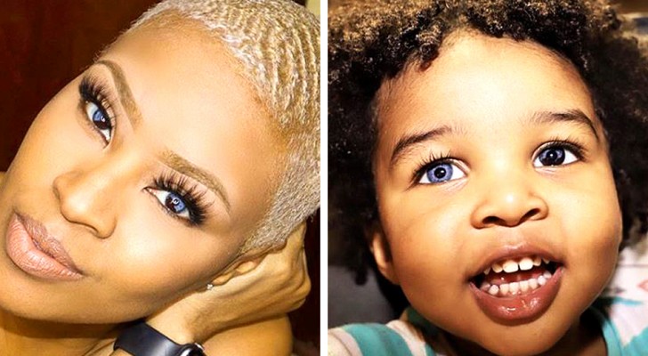 Madre e figlio hanno gli stessi splendidi occhi "multicolore": una condizione genetica rara e affascinante