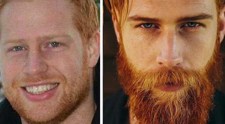 19 men who decided to grow a beard to improve their appearances