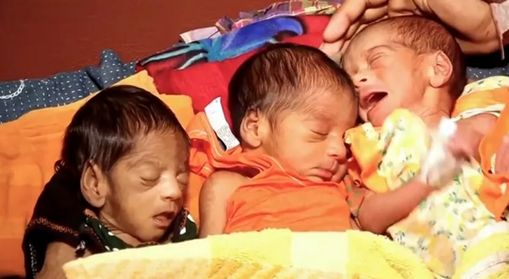 Eine Frau bringt ein Frühgeborenes zur Welt und bringt 27 Tage später Zwillinge zur Welt