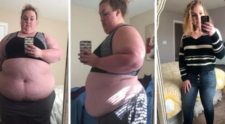 Pesava 218 kg e si muoveva a stento: quando i medici le hanno detto che rischiava la vita, ha avuto la forza di cambiare