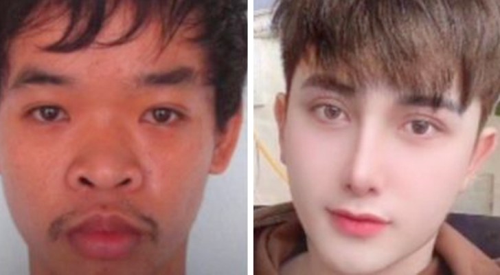 At 26 he undergoes 9 surgeries to help him find work: now he is practically a different person