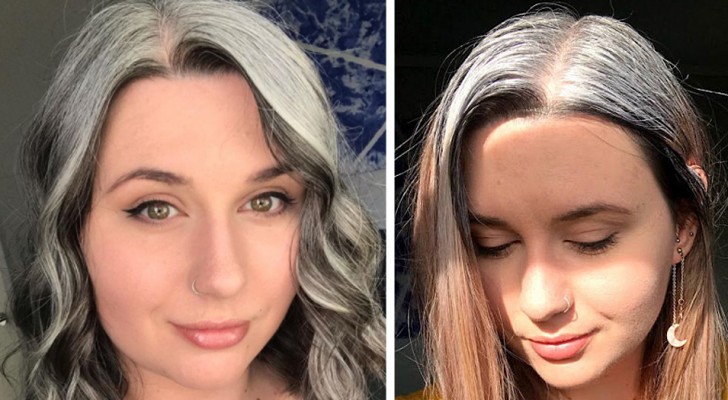 Mit 25 beschließt sie, ihr graues Haar stolz zu zeigen: 