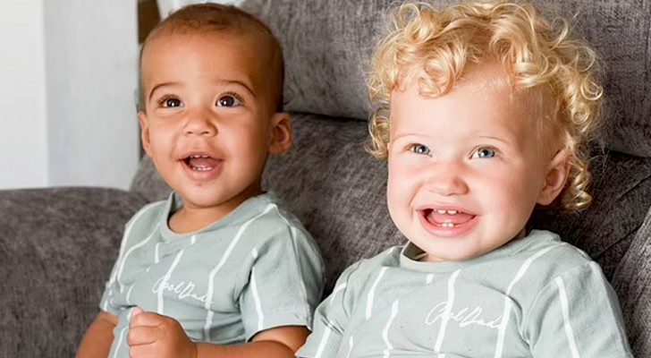 They have different skin colors but they are biological twins: the case of these 2 siblings is very rare