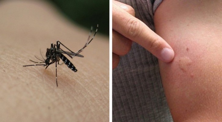Warum werden wir mit Beginn des Sommers mehr als andere Leute von Mücken gestochen?