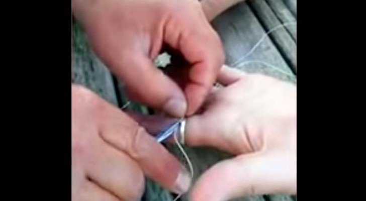 A ring is stuck on your finger ? Here's an amazing trick to remove it in just a few seconds !