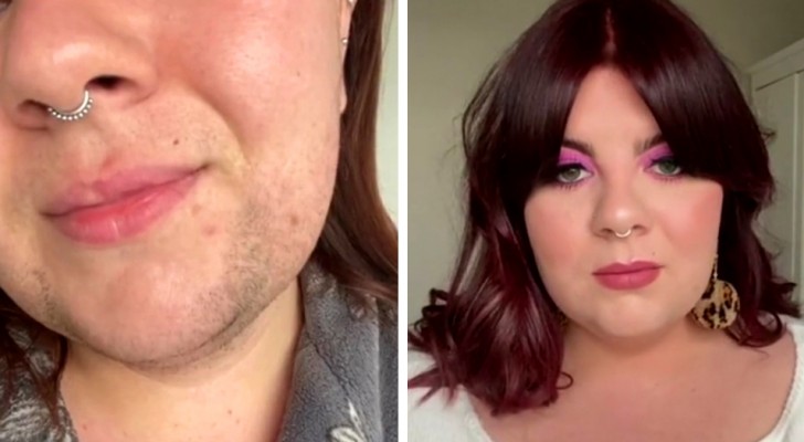 A young woman shows her "beard" on video and defends herself against criticism from those who say she looks like a man