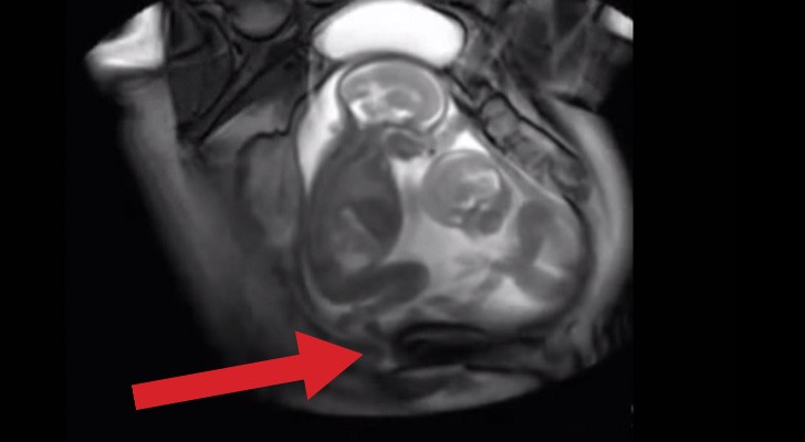 Uma mulher grávida de gêmeos faz uma ecografia: o resultado é muito engraçado