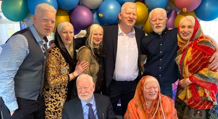 I den här familjen är alla 6 syskonen albinos