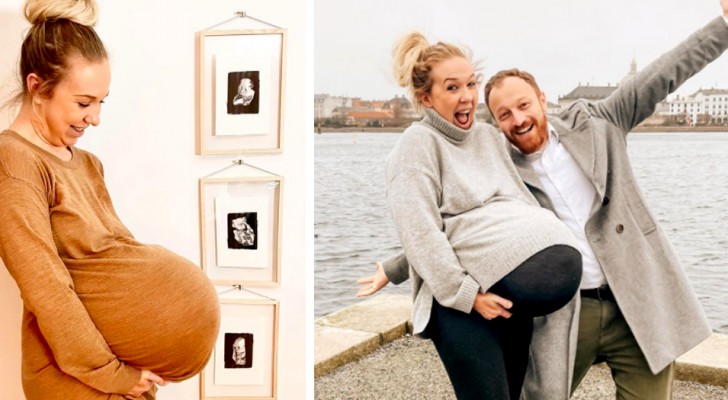 This pregnant woman's belly is so big and weirdly shaped, it doesn't even seem real