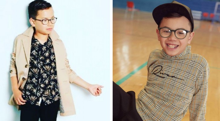 Autistic boy, excluded from class photos, gets "revenge" by becoming a model