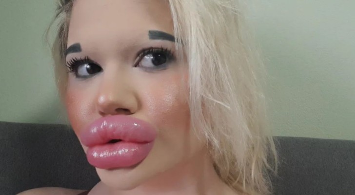 Den här unga kvinnan har spenderat 5000 dollar på att förstora läpparna, men hon slutar inte där