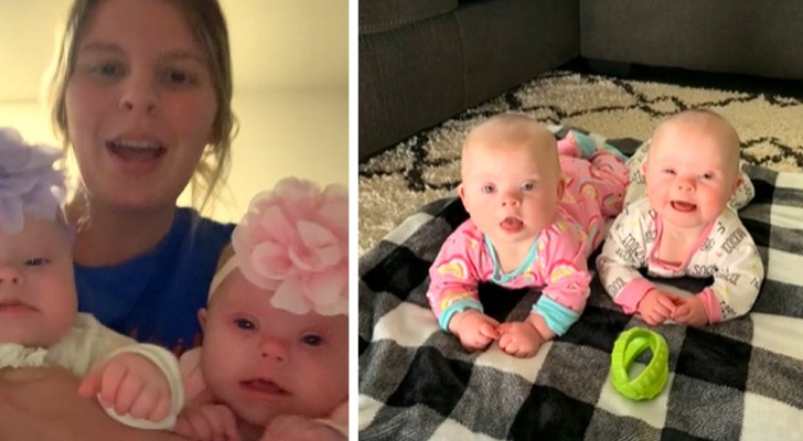 Da a luz a dos gemelas con síndrome de Down y dice: "Mis hijas son hermosas así como son"