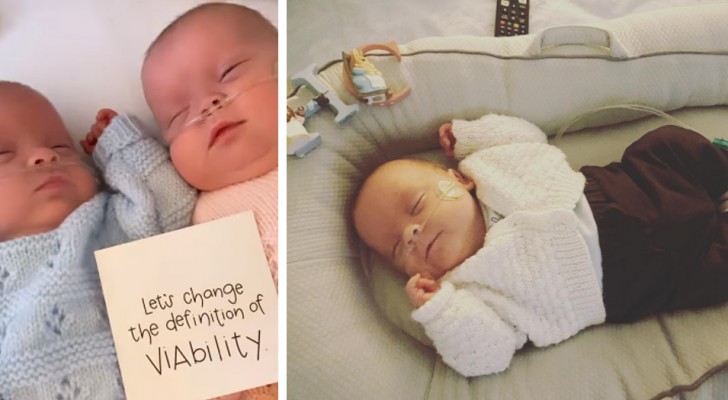 Nascono a sole 22 settimane e conquistano il titolo di "gemelli più prematuri del Regno Unito"
