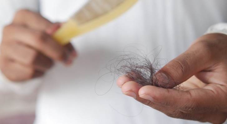 Alopeci: vad det är, varför man drabbas och hur man behandlar en sjukdom som får dig att tappa hår
