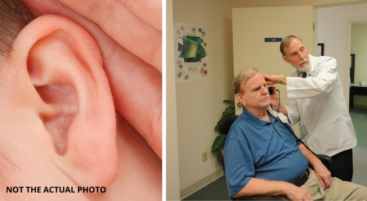 Forschung entdeckt eine Therapie, die Hörverluste ohne Implantate wiederherstellen kann