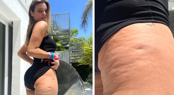 Ex-model shows off her imperfections on social media and sends a message: "Accept your cellulite"