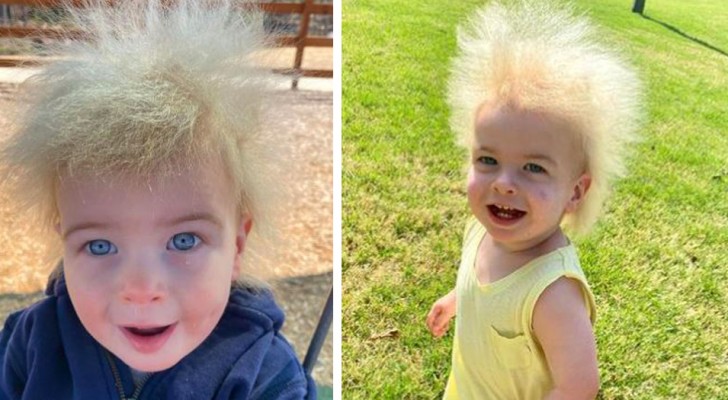 Questo bimbo ha i capelli ingovernabili per una rara condizione genetica: le sue foto spopolano sul web