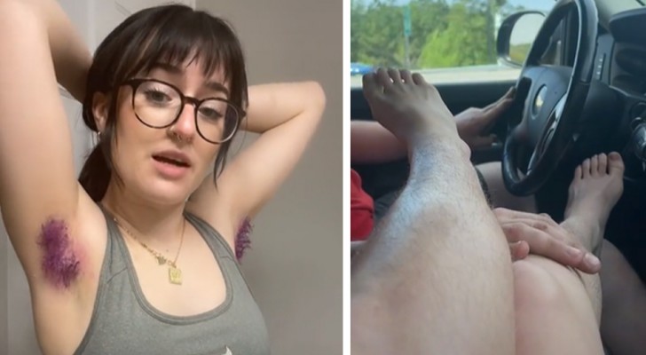 Young woman is proud of her leg and armpit hair: My boyfriend loves it