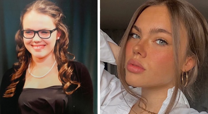 Her boyfriend left her because she was not pretty enough; today she is a model and got her 