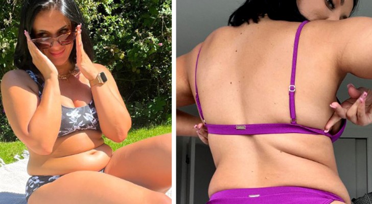 "Visa din mage och skäms inte över din kropp" - En influencer uppmanar alla kvinnor att bära bikini