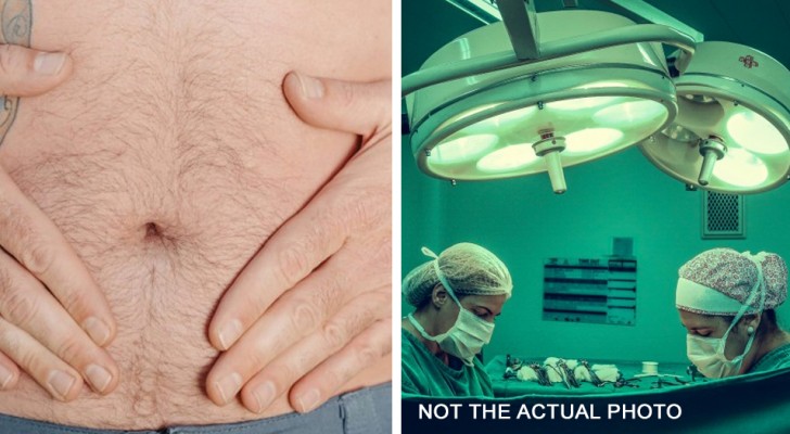 33-year-old man complains of abdominal pain every month: he discovers he has ovaries and uterus
