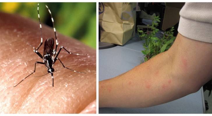 5 DIY-sätt för att försöka undvika myggbett
