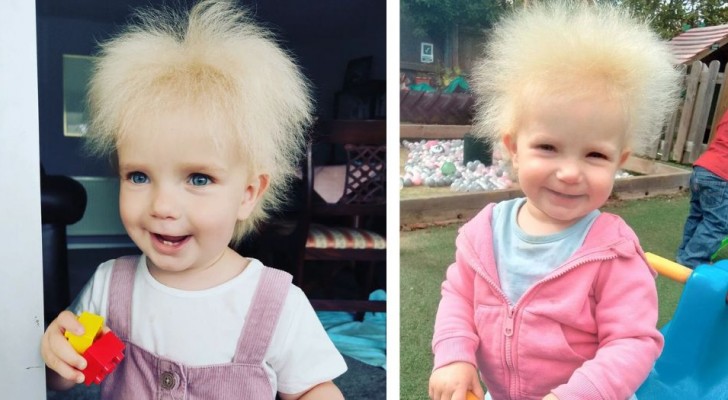 Das kleine Mädchen mit den unbezwingbaren Haaren: Eine extrem seltene Krankheit hat sie zu einem kleinen sozialen Star gemacht