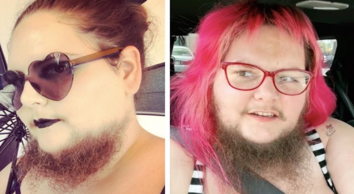Deze vrouw heeft besloten haar imperfecties te accepteren en haar baard te laten groeien: 