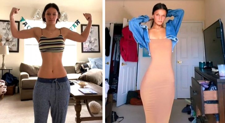 This woman has an abdomen which is much more elongated than normal: "on the internet they told me I look like a centipede"