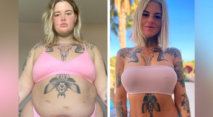 Woman sheds unwanted weight thanks to surgery and exercising: 