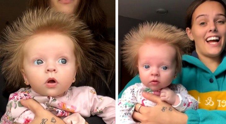 Niña de 10 semanas se hace famosa por su cabello "rebelde": su crecimiento parece imparable