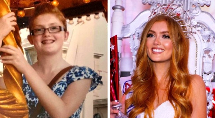 Bullies teased her about her red hair: when she grew up, she won the Miss England beauty contest
