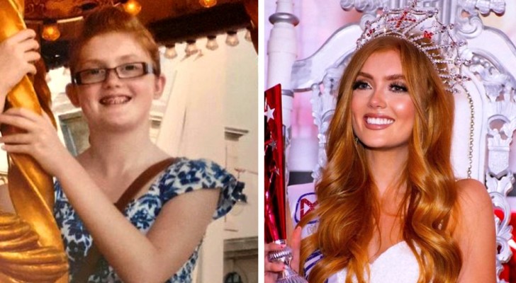 Bullies Teased Her About Her Red Hair When She Grew Up She Won The Miss England Beauty Contest