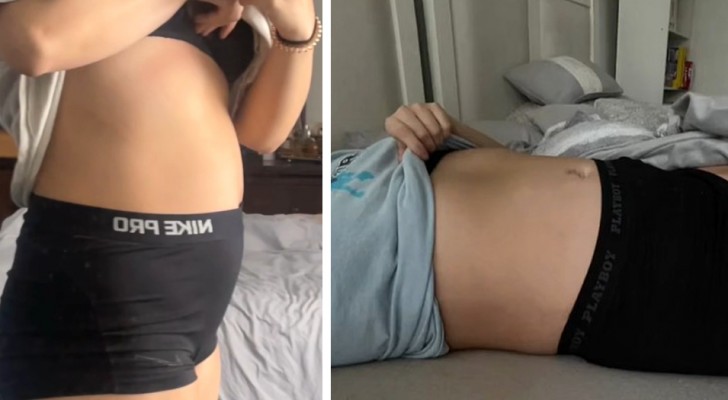 Woman is pregnant but her belly doesn't swell: in the ninth month, it just looked a little 