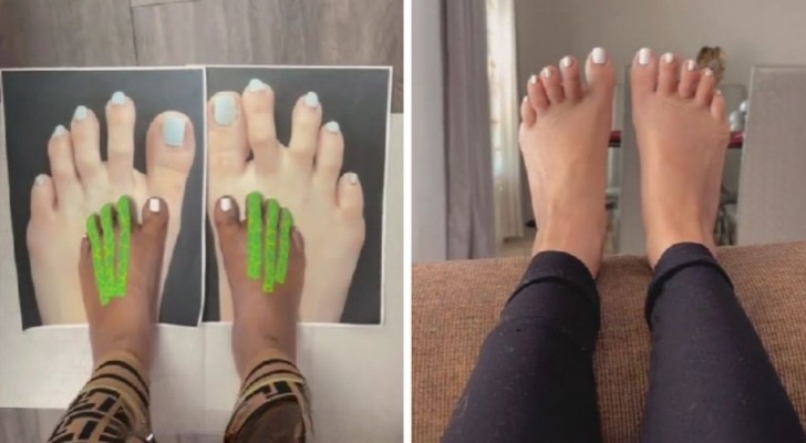 Elle déteste ses doigts de pied et décide de les faire raccourcir : 