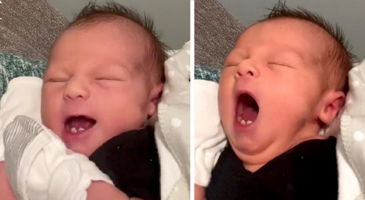En bebis föds med två tänder i munnen: 