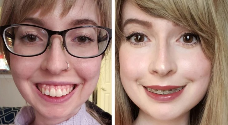 13 personnes à qui la chirurgie a donné un nouveau visage et beaucoup plus d'estime de soi