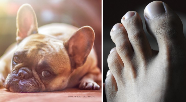Mentre dorme il cane gli frattura l'alluce: grazie a questo scopre di essere in pericolo di vita
