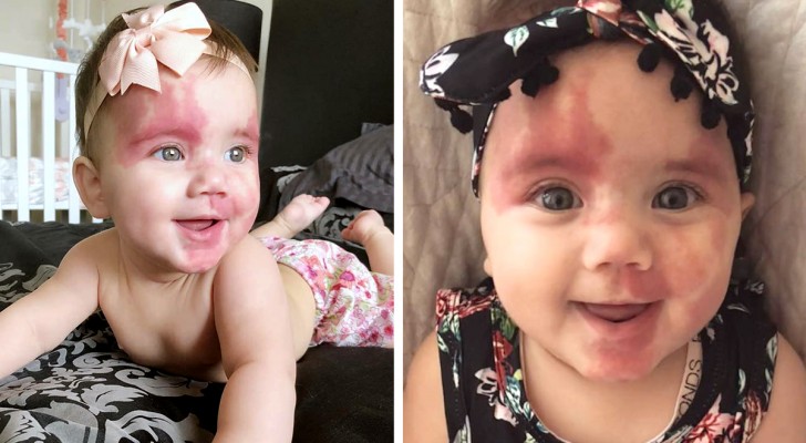 Lots of people say this little girl is ugly: her mother strikes back