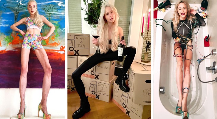 Woman spends almost $145,000 to have her legs elongated: "Now my life is complete"