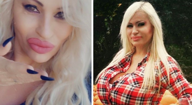 Hon spenderar 800.000 pund för att bli vackrare: "Jag misstas för min sons flickvän"