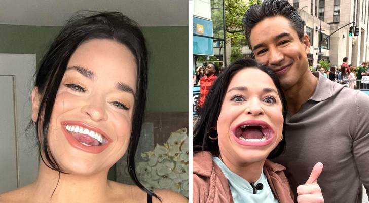She has the widest mouth in the world: "I've always been laughed at, but now I'm earning thousands of dollars" (+ VIDEO)