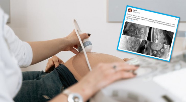 Dessa ultraljudsbilder på en graviditet har blivit virala eftersom de framkallar mardrömmar