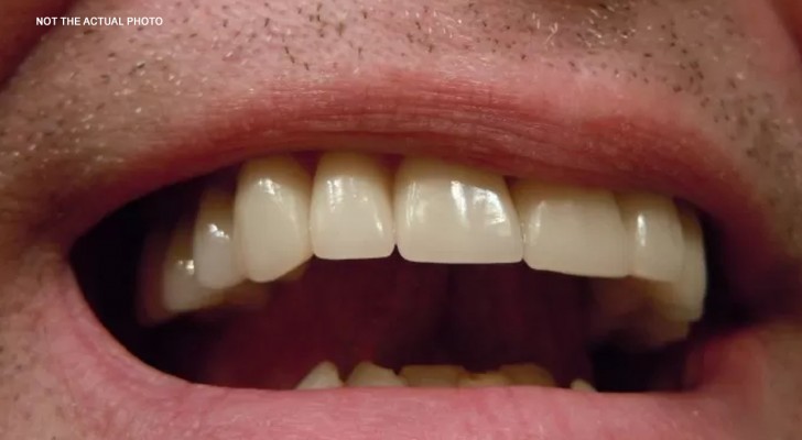 Team di ricerca ha scoperto un modo per far ricrescere i denti caduti