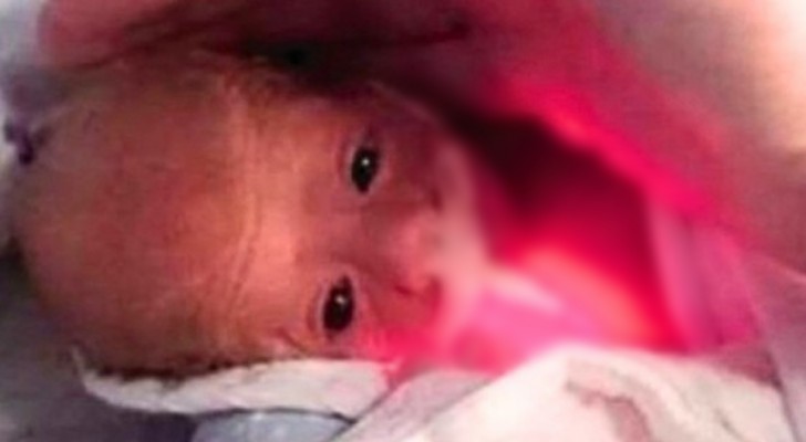 Bei seiner Geburt wog er nur 600 Gramm: heute ist er ein Baby mit wunderschönen blauen Augen